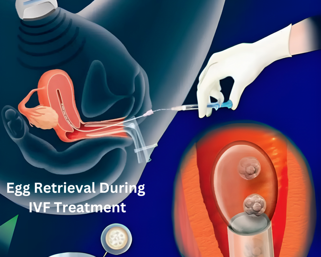 egg retrieval during IVF treatment